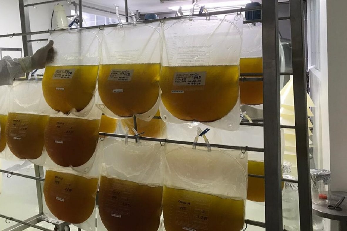 Plasma separation Bags of yellow plasma suspended on a rack in a laboratory.
